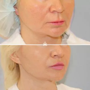 Булхорн